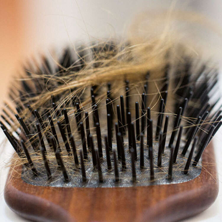 Das Bild zeigt eine Bürste mit ausgefallenen Haaren in den Borsten